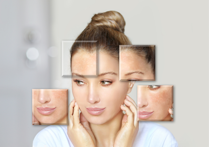 Tình trạng xạm da do thiếu vitamin C
